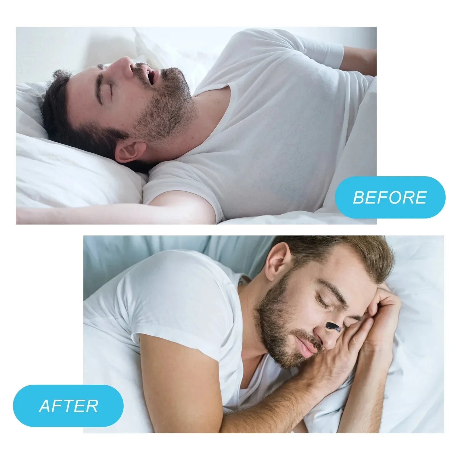 Anti-snoring nose clip