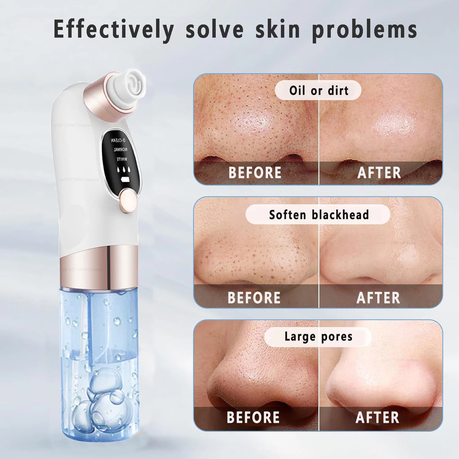 Blackhead Remover, Electric Facial Cleanser